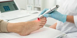 Laser bunion removal procedure on a foot, a key factor in the overall cost.