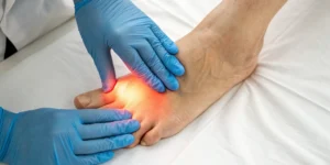 Doctor examining a patient's foot to diagnose the cause of metatarsalgia pain.
