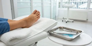 Foot with a hammertoe deformity prepared for minimally invasive toe surgery.