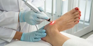 Laser therapy for bunion correction performed on a foot.